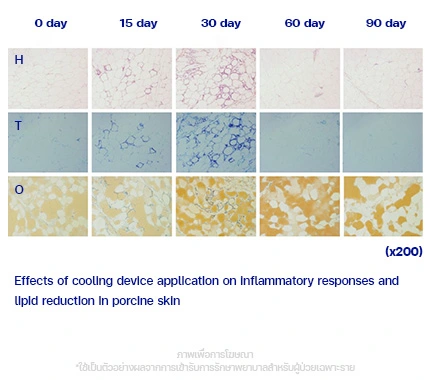 CoolShaping2-ผลลัพธ์จากงานวิจัย-การย้อมเนื้อเยื่อ