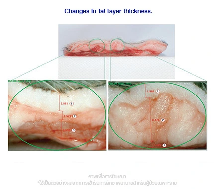 CoolShaping2-ผลลัพธ์จากงานวิจัย-รูปตัดชั้นไขมัน